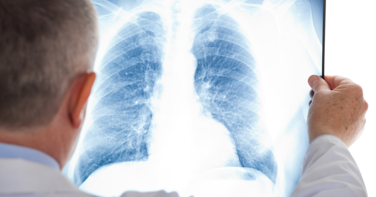 What are the symptoms of pneumonia and how to prevent it?  TsGZ explains