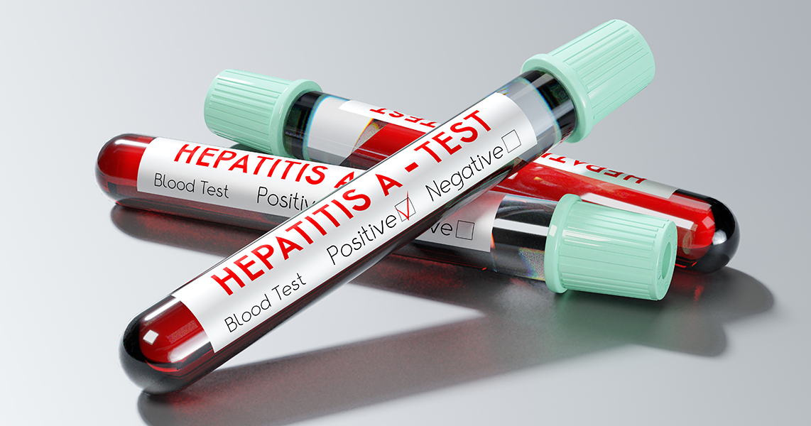 The situation with hepatitis A in Vinnytsia is stabilizing – Ministry of Health
