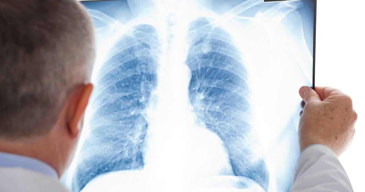 Lung cancer resistance to treatment may not be genetic, scientists find: What does this mean?