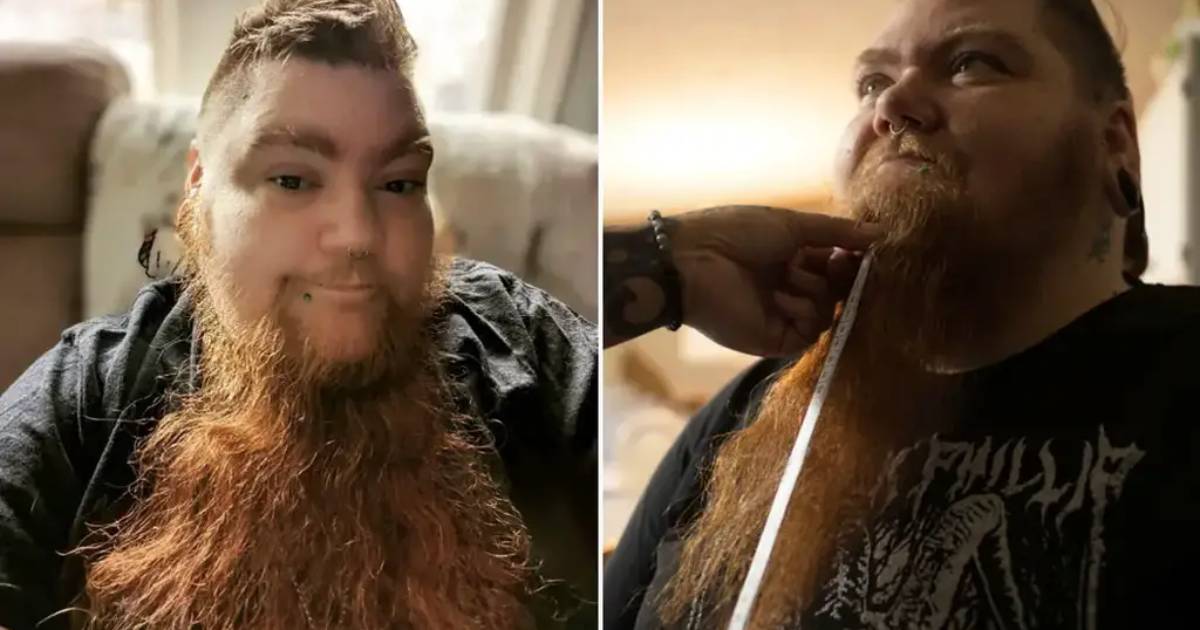 An American woman grew a 30-centimeter beard and entered the Guinness Book of Records.  VIDEO